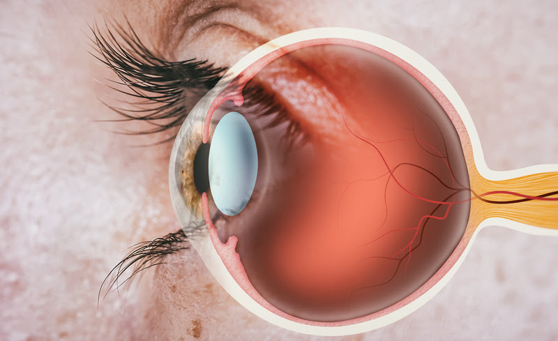 Estudo aponta que 20,2% das pessoas com diabetes no Brasil têm retinopatia