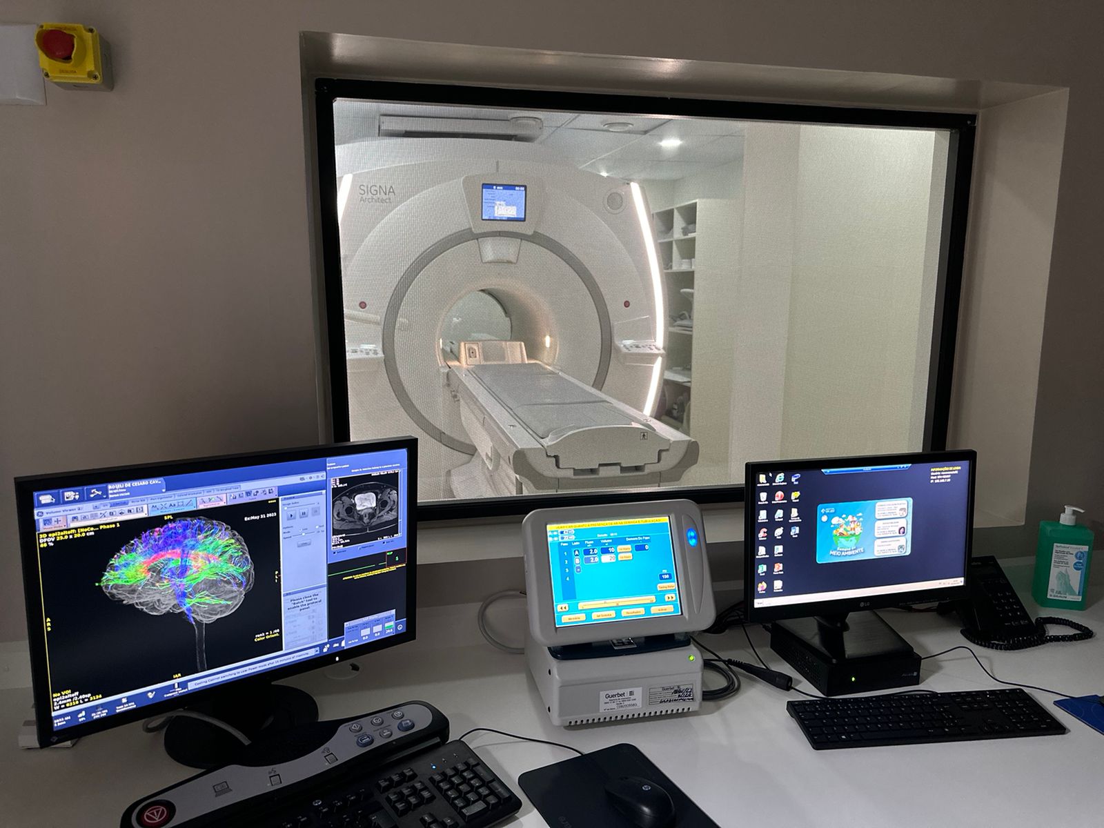 &ldquo;AVC silencioso&rdquo;: neurologista do HSJos&eacute; fala da import&acirc;ncia da preven&ccedil;&atilde;o