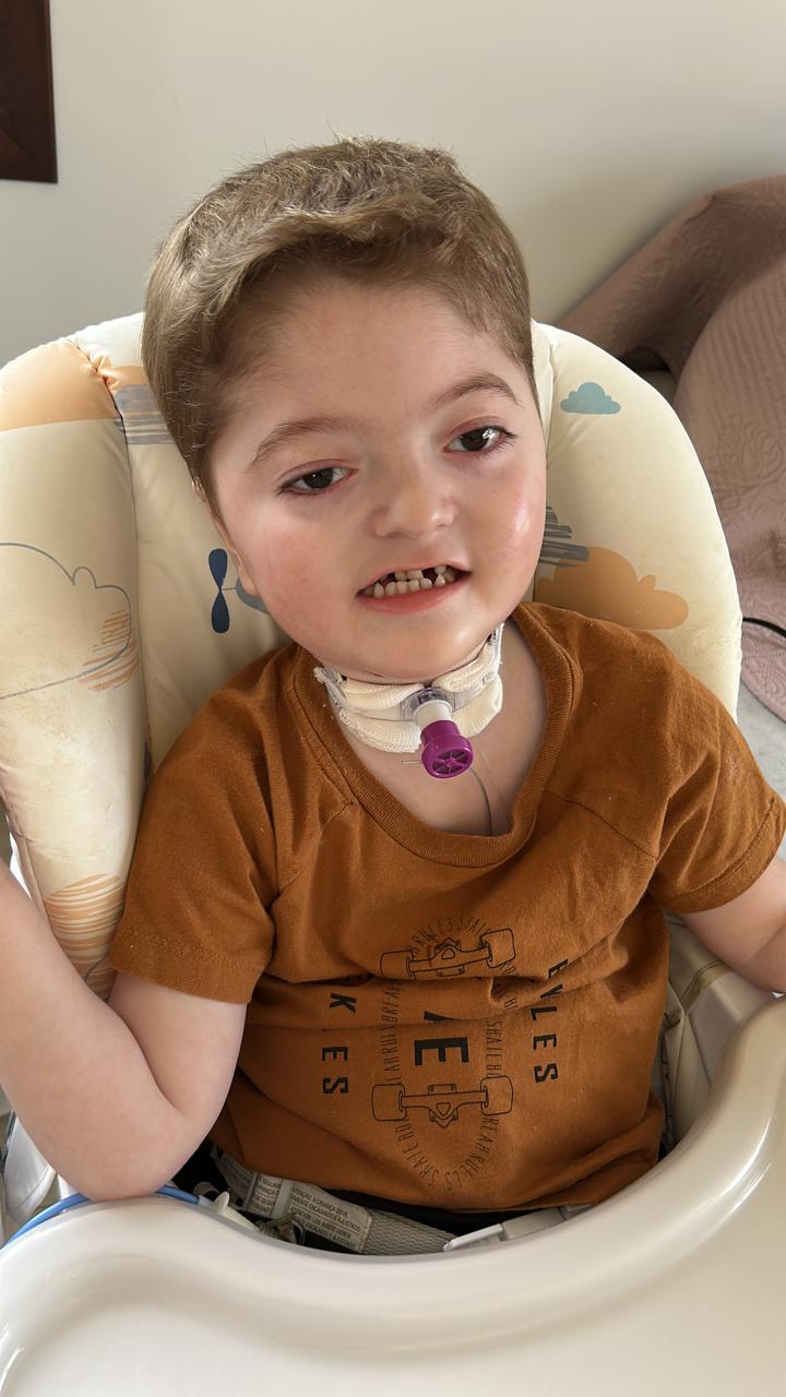 Campanha para custear equipamentos vitais para crian&ccedil;a de 3 anos em I&ccedil;ara (SC)