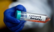 Cientistas chineses anunciam descoberta contra coronavírus (covid-19)