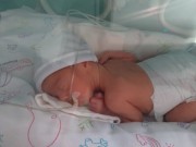 Novembro Roxo: Mês é dedicado à prevenção da prematuridade em SC