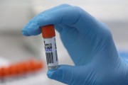 Procon notifica planos de saúde e laboratórios para autorizar testes da Covid-19