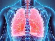 Estudo demonstra potencial de novo tratamento oral para o câncer de pulmão