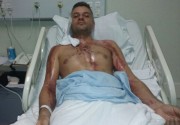 Motociclista se recupera após ser atingido por um raio