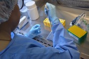 Governo do Estado firma parceria com UFSC para testes de detecção do SARS-COV-2