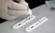 Coronavírus: Governo brasileiro anuncia plano de testes com 22% da população