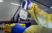 Governo de SC investe em kits para 5,4 mil testes de Covid-19 por biologia molecular
