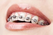 Unesc oferece tratamento em Ortodontia